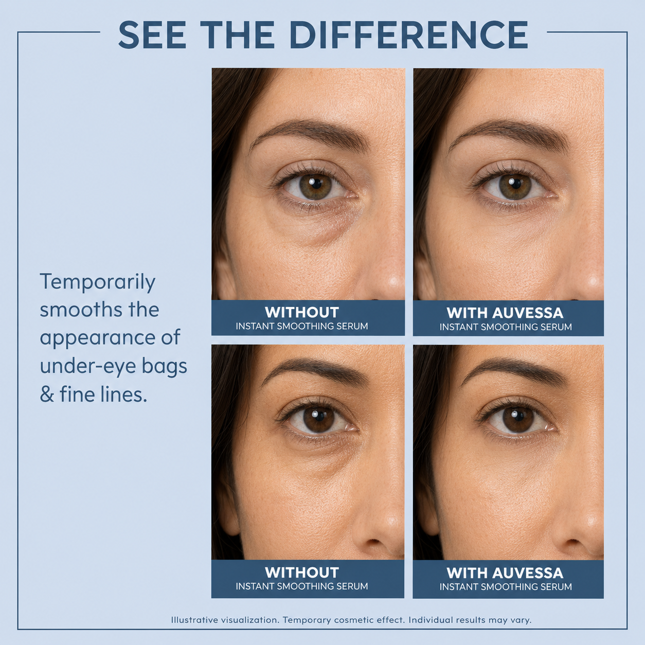 Reduction Eye Serum